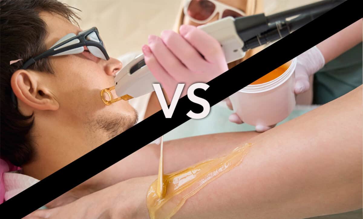 Hair Removal vs. Laser Hair Removal