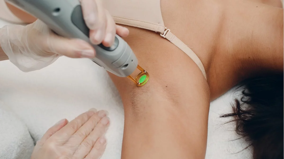 laser hair removal on a woman's underarm