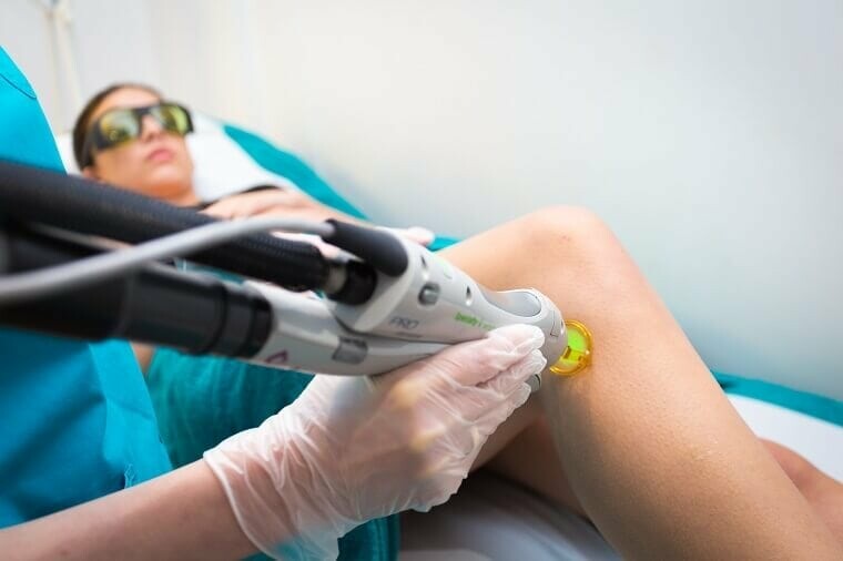 Laser Hair Removal process