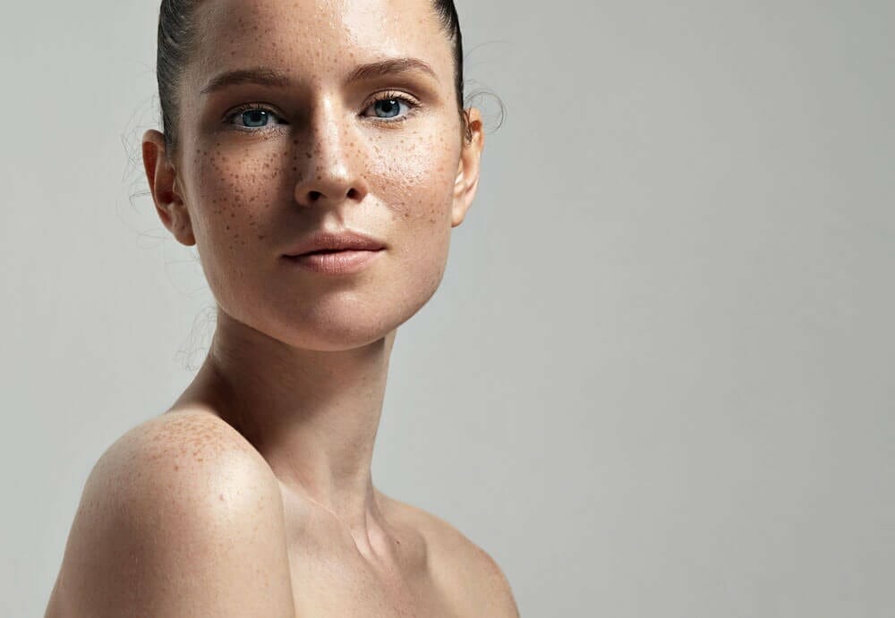 Freckles vs. Pigmentation