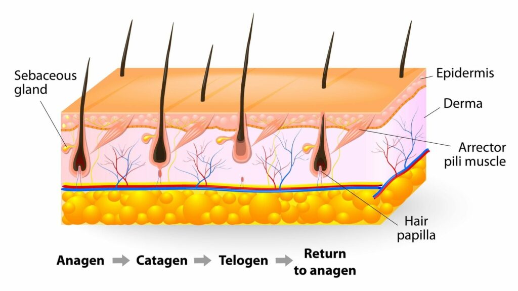 Epilation vs Laser Hair Removal London Premier Laser & Skin Clinic
