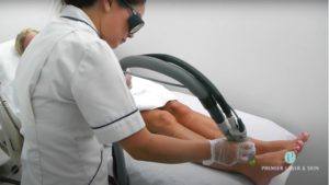 laser hair removal bromley