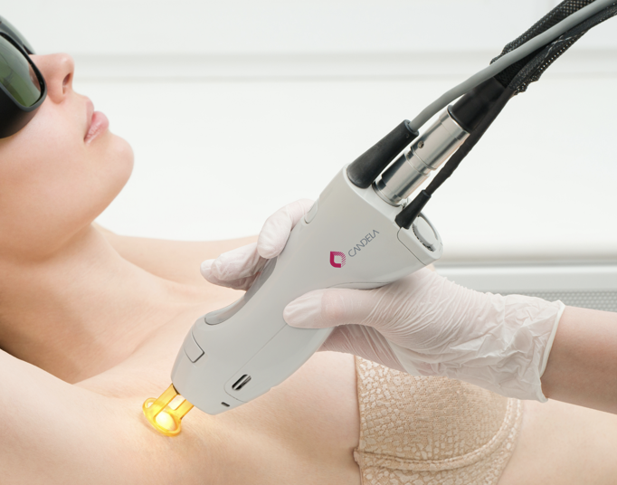what is the timeline for laser hair removal