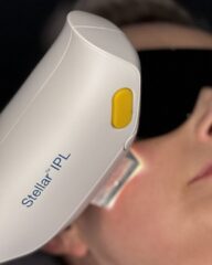 STELLA M22 IPL