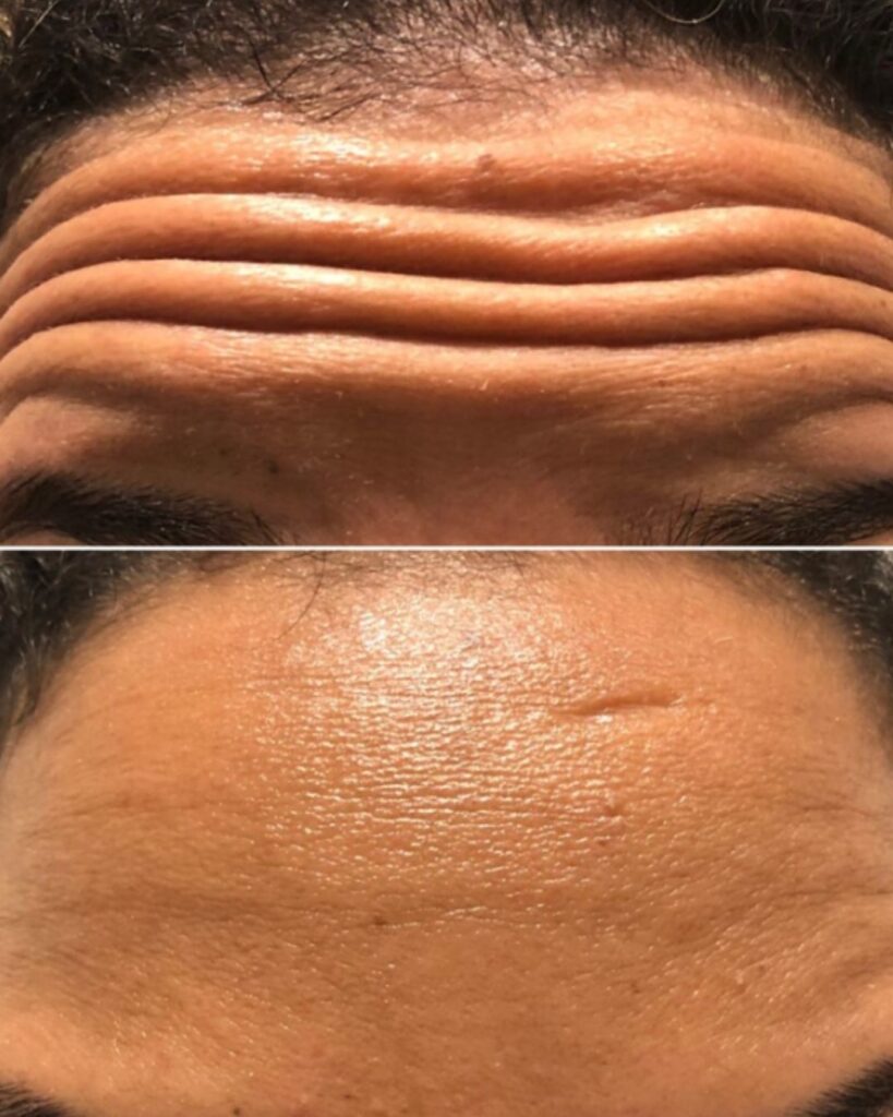 Before and after