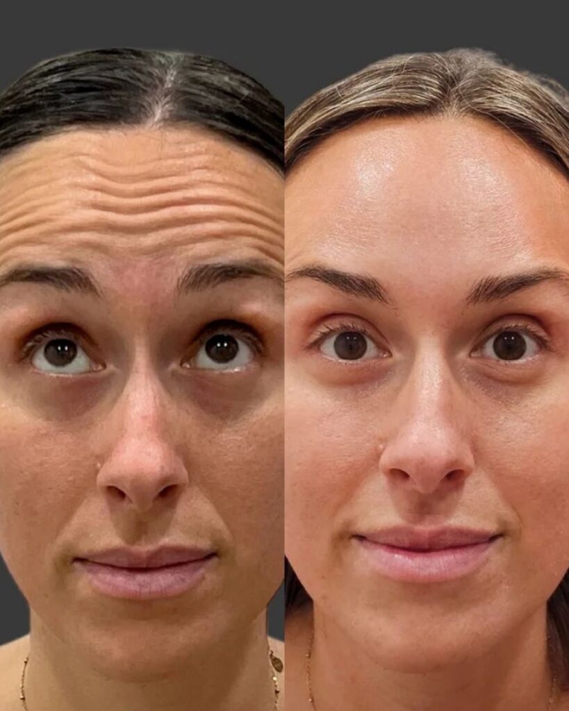 Before and after