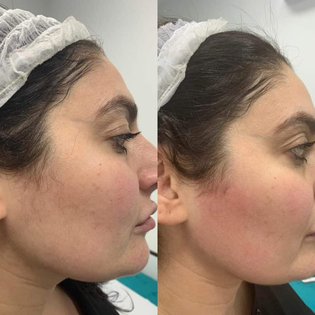 Before and after