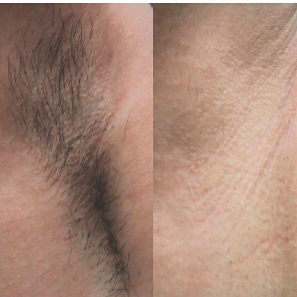 Before and after