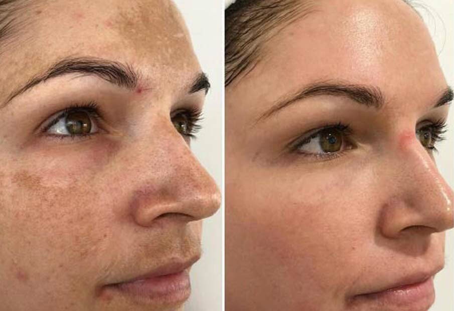 Before and after