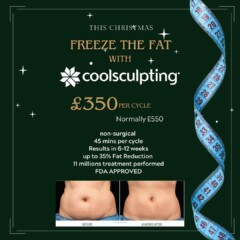 Christmas coolsculptong offer