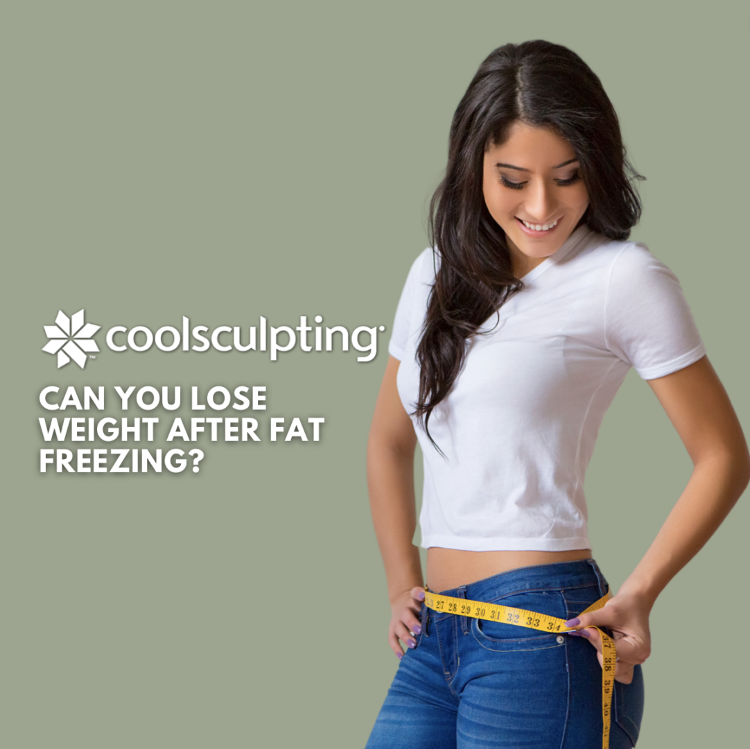Can You Lose Weight After Fat Freezing?
