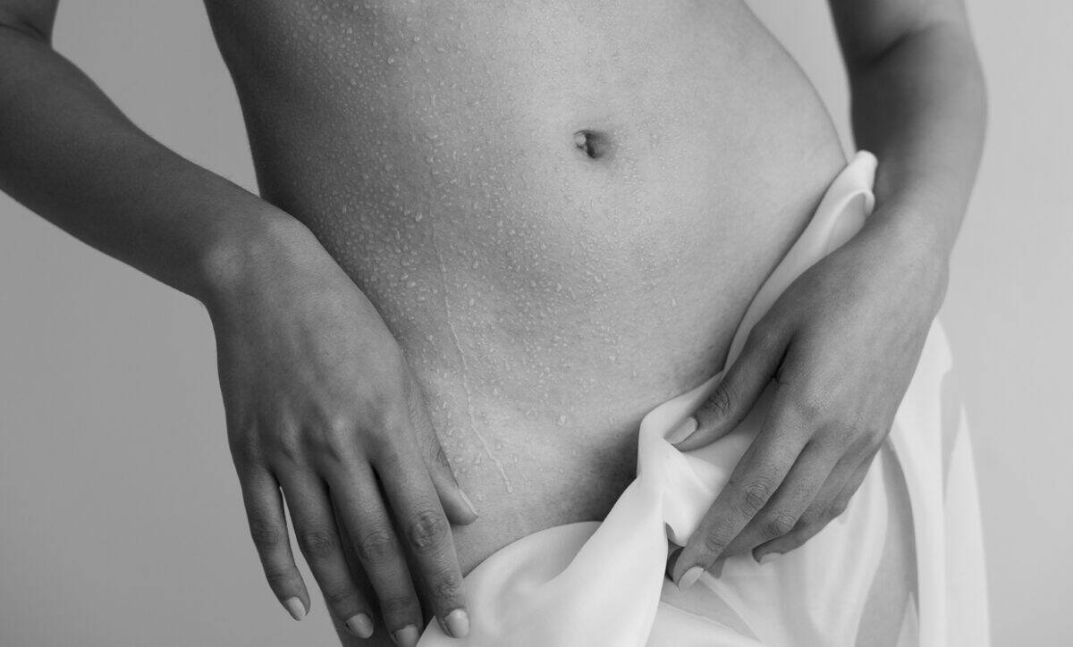laser hair removal pubic hair