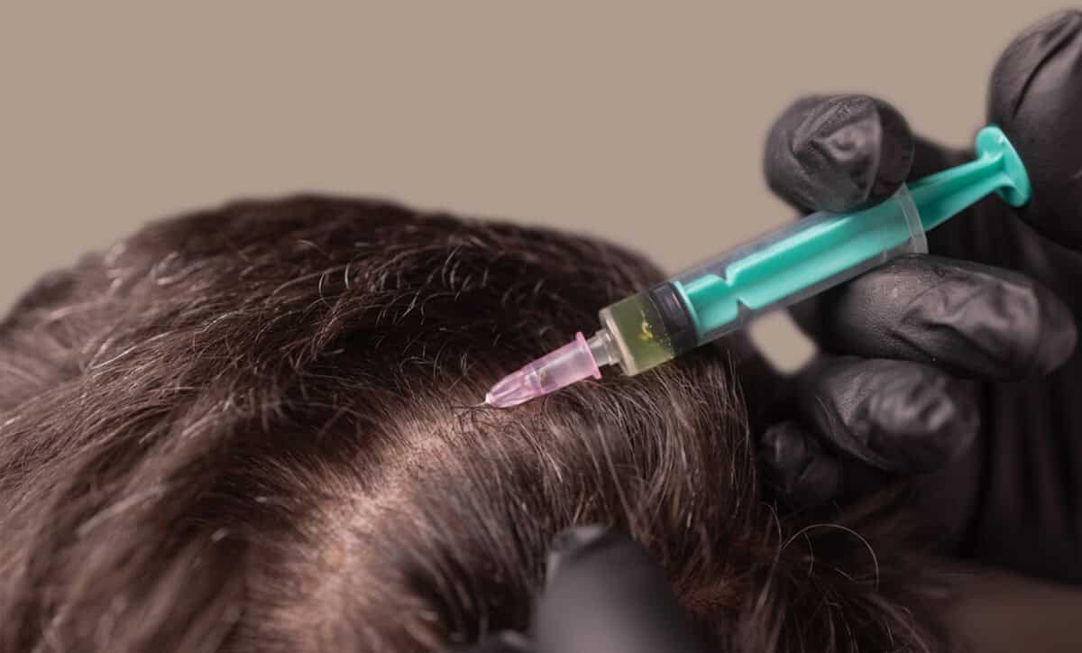 Do Exosomes Regrow Hair?