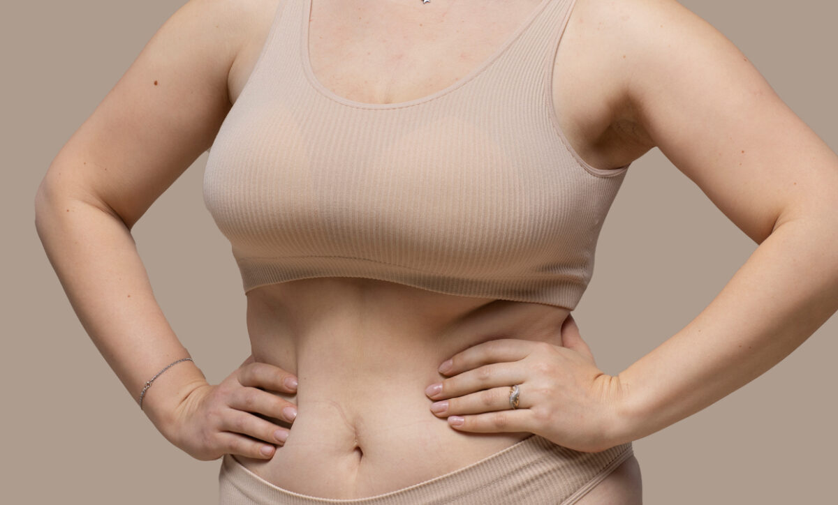 What Is the Best Fat Dissolver?