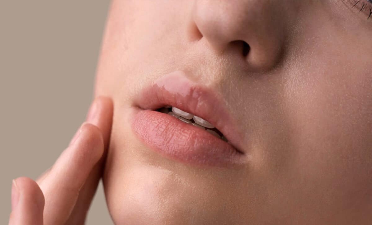 Is It Okay to Laser the Upper Lip?