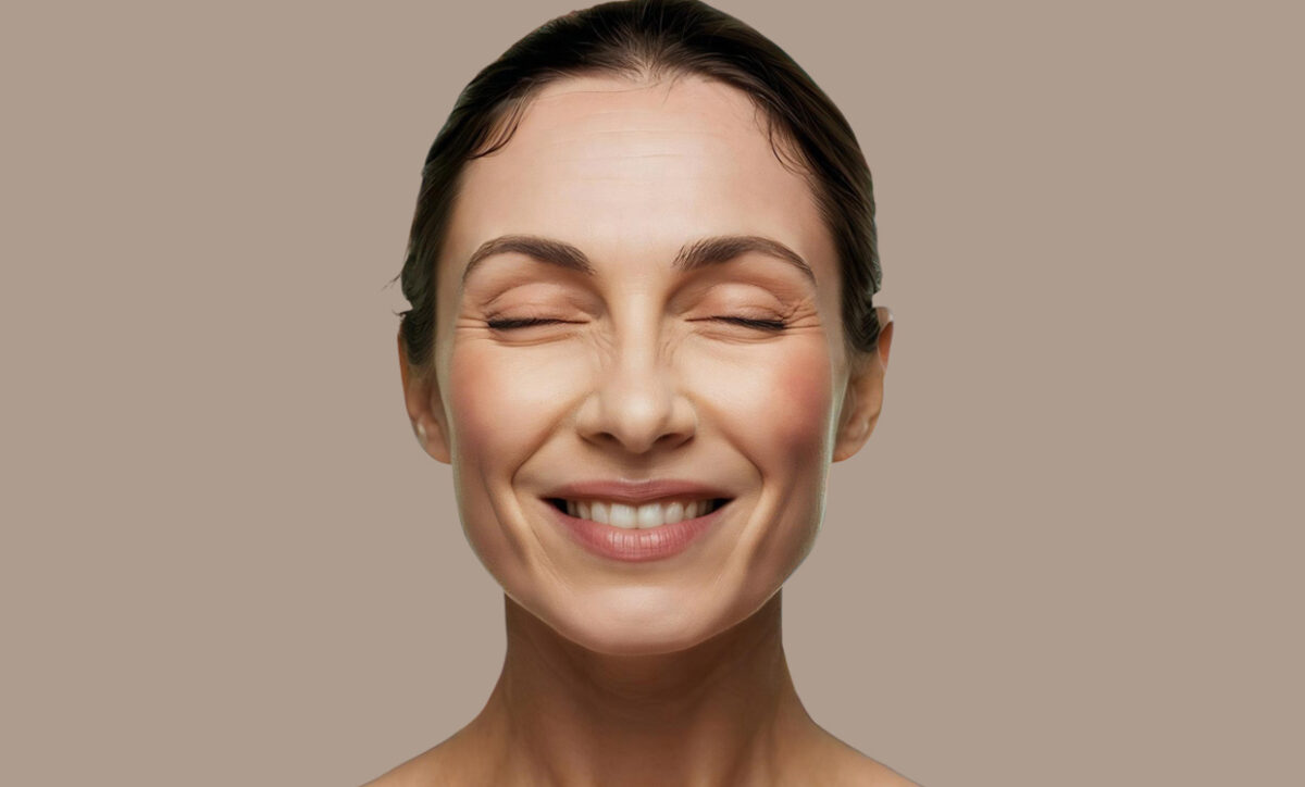 When I Smile, I Have Wrinkles Under My Eyes