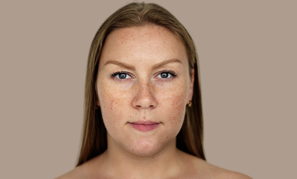 Can You Reverse Pigmentation on Your Face?