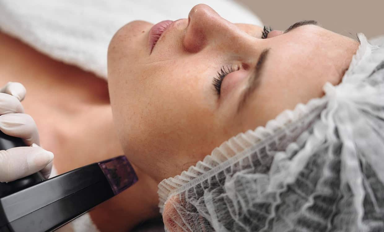 Can You Do Morpheus8 in the Summer? - London Premier Laser & Skin Clinic