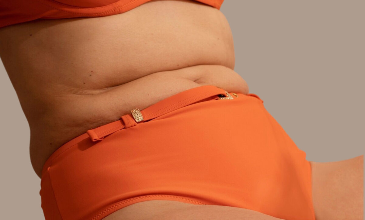 Can Exilis Help with Stubborn Belly Fat?