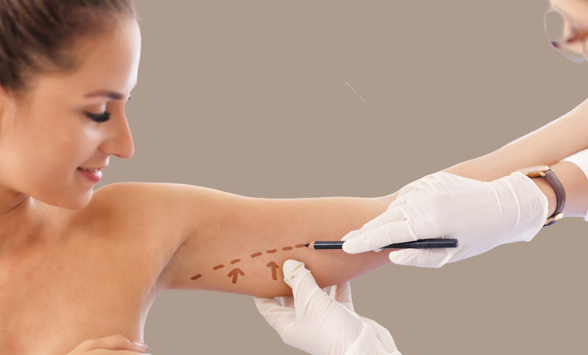 Polynucleotide Injections – Can They Tighten Body Skin?