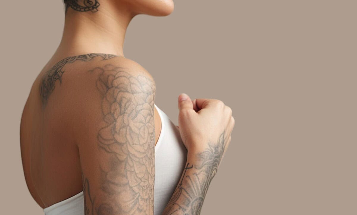 How Many Sessions Does Tattoo Removal Take with PicoSure?