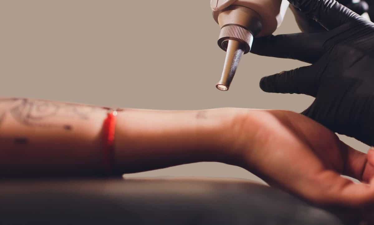 Medical Tattoo Removal London