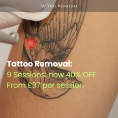 tattoo removal may banner