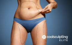 CoolSculpting vs CoolSculpting Elite: What’s the Difference?