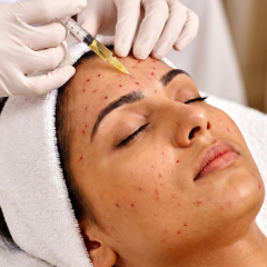 What is PRP?