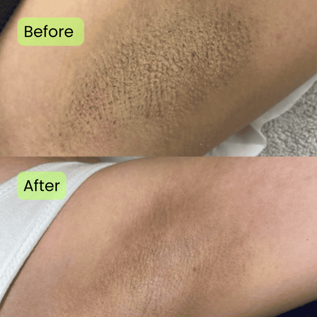 Before and after
