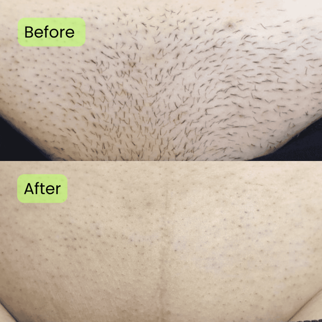 Before and after