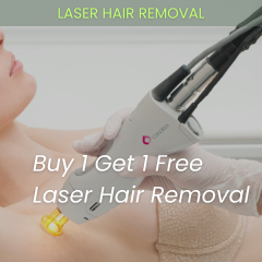 laser hair removal underarms
