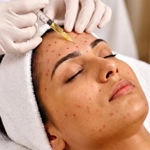 What is PRP?
