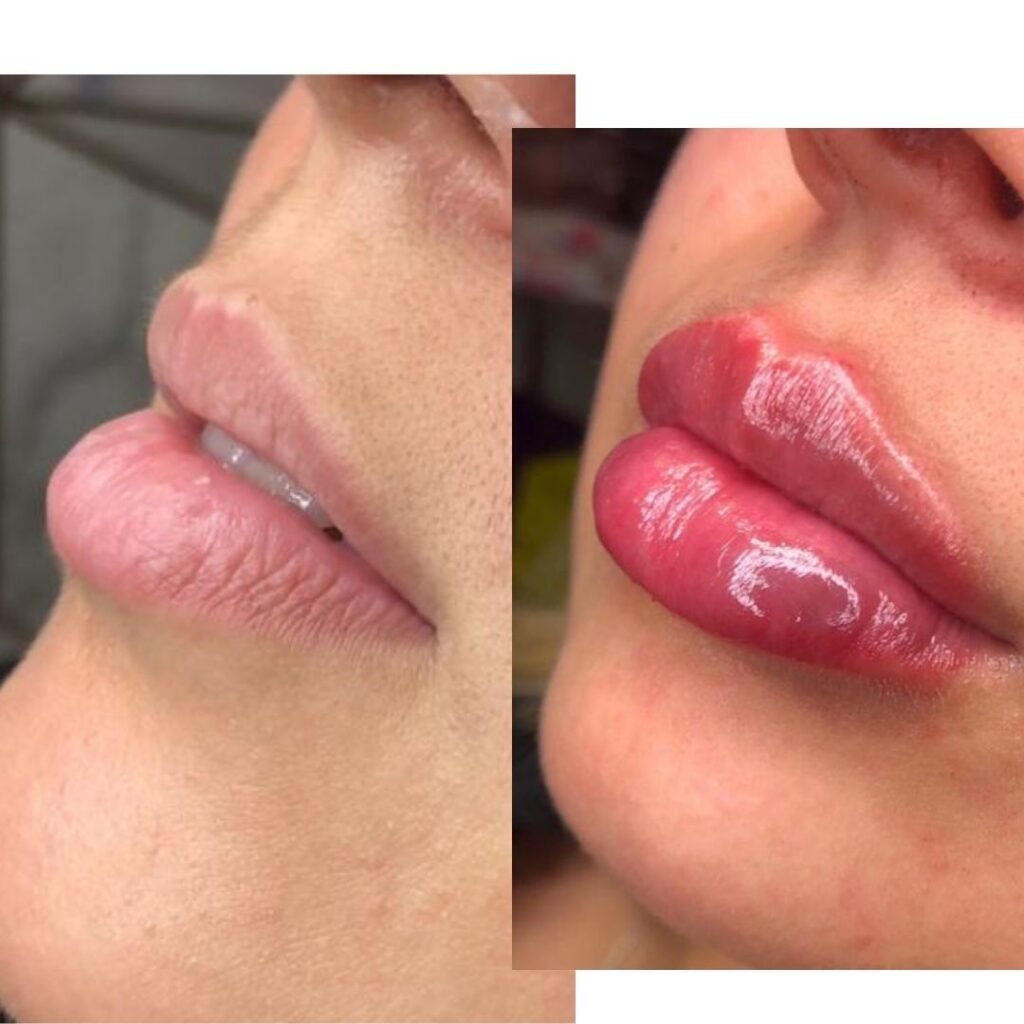 Before and after