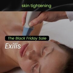 exilis skin tightening treatment on woman