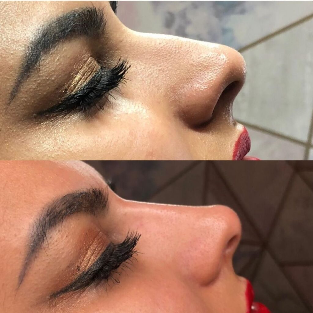 Before and after