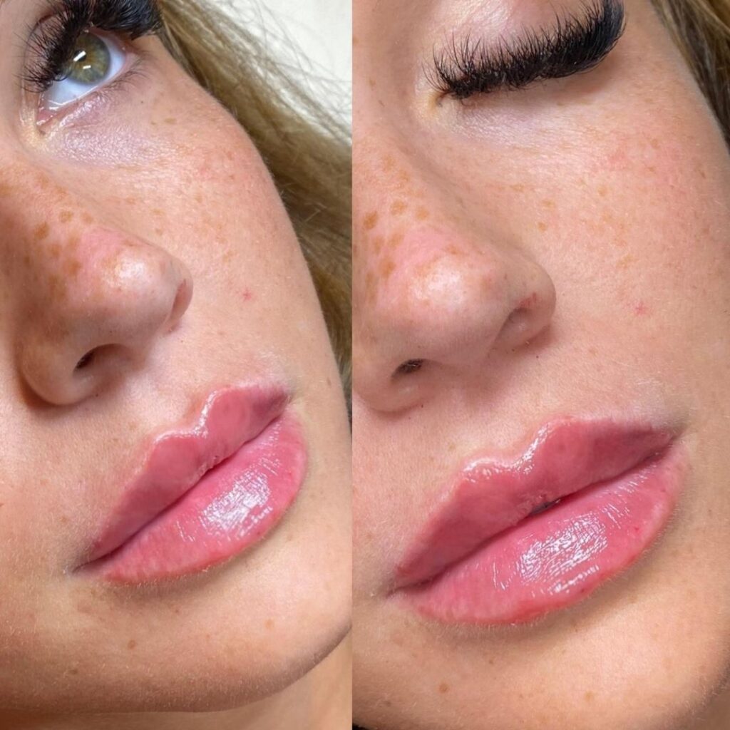 Before and after