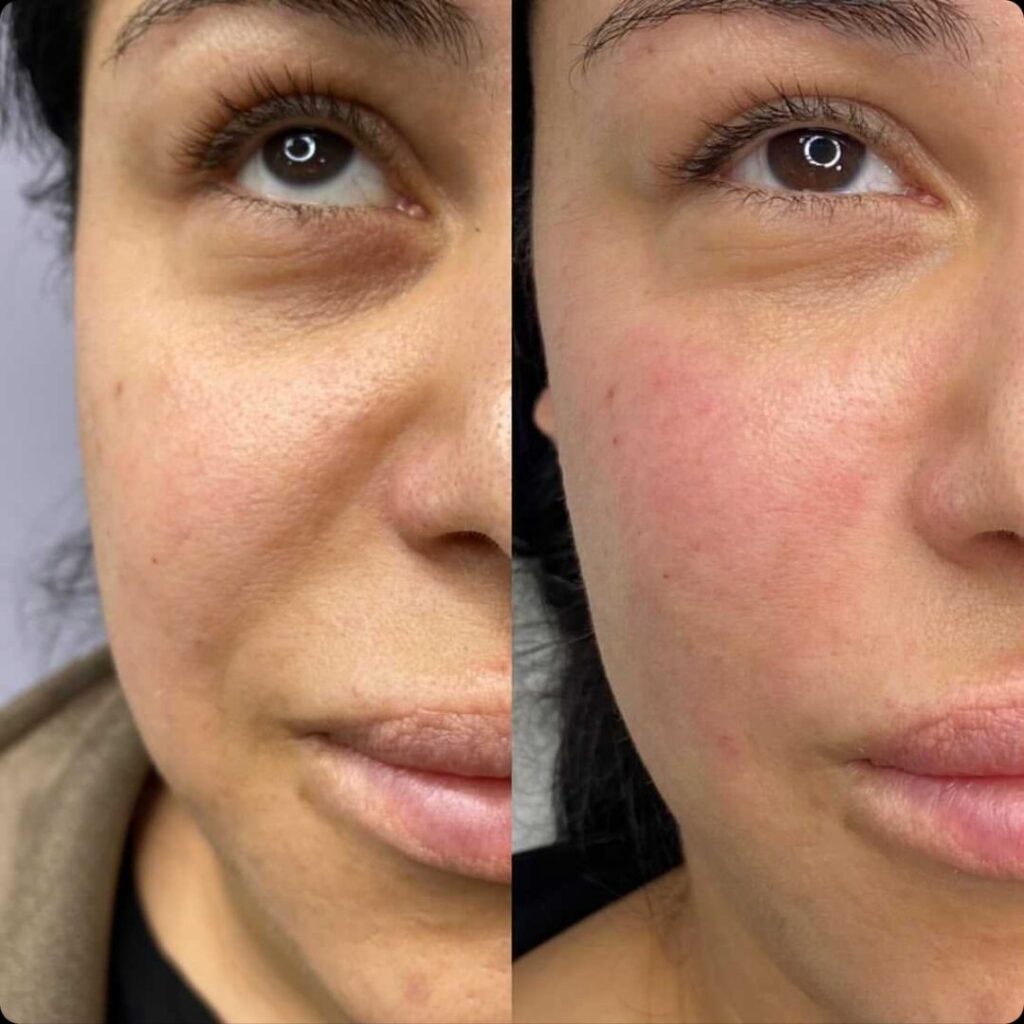 Before and after