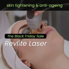 Revlite laser on skin face