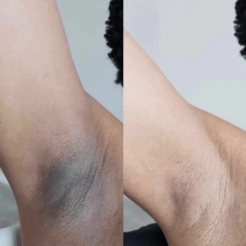 Before and after